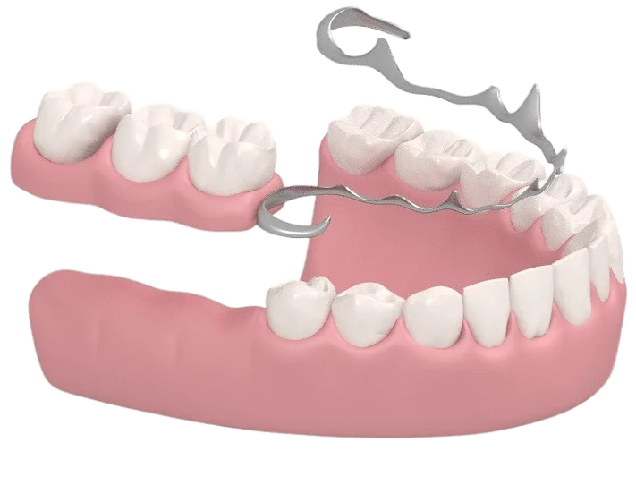 Баннер <span class="wow fadeTextBg animContrastTextBg">Бюгельные протезы в Калуге</span>
